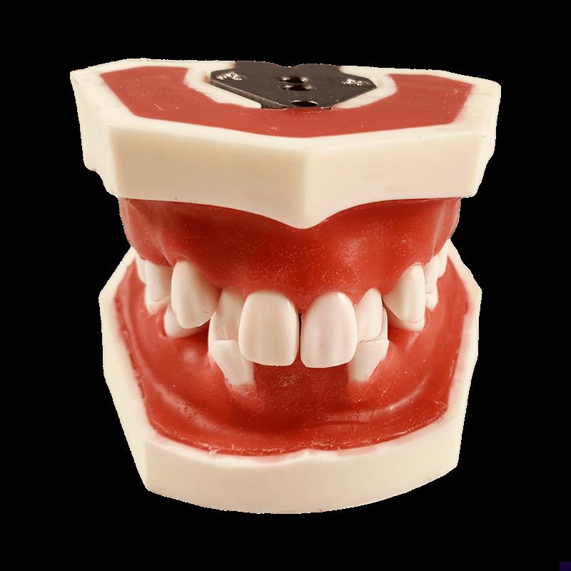 牙模型备牙牙科口腔矫正牙周x模型练习牙结石刮治软牙龈牙列不齐