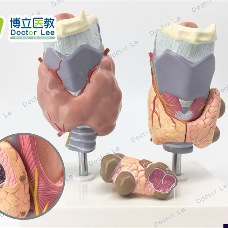 人体甲状腺病理模型甲v亢甲低甲减内分泌系统医学解剖
