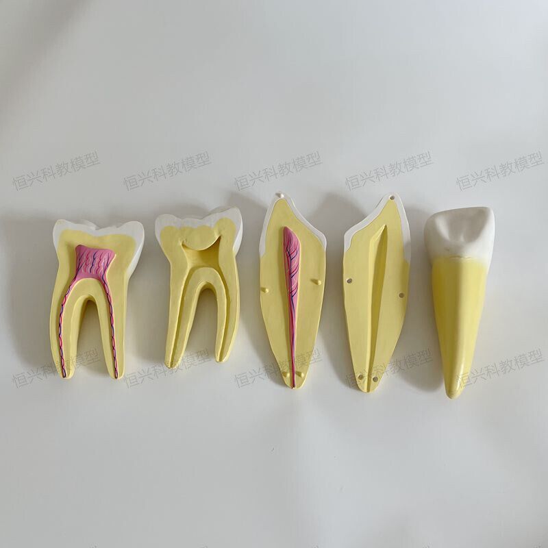 蛀牙发展过d程牙根牙髓腔神经血管口腔牙科医生建模病理牙可拆卸