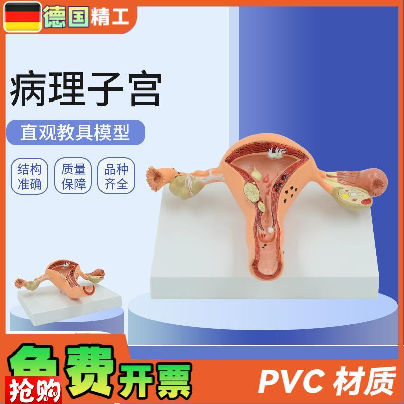 德国人体模型女性生殖子宫阴道卵巢D子宫教学模具病理变化科普培