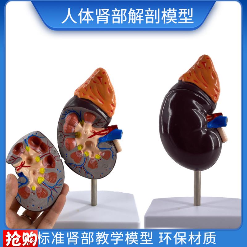 人体肾解剖模型2部件p正常肾脏病理肾部模型专业内脏器官医学教具