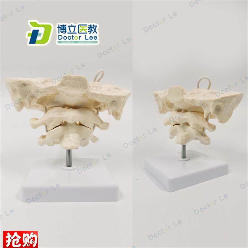 后枕骨颈椎带颈动脉椎间盘与C神经教学模型腰椎骨骼架模型