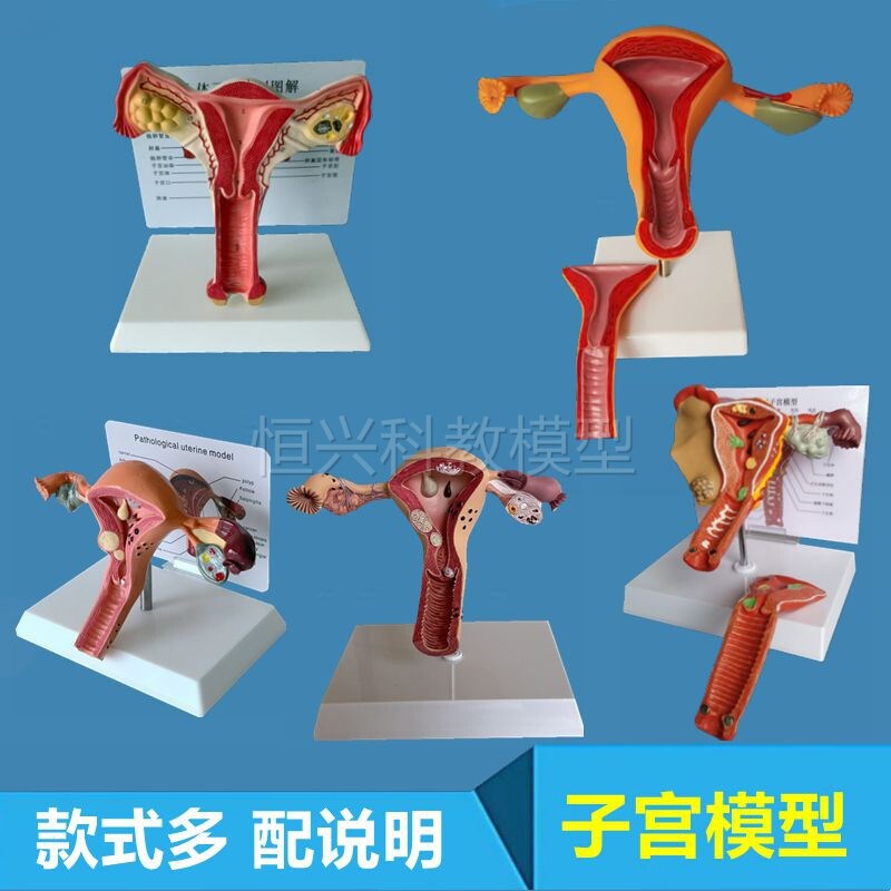子宫模型健e康病变卵巢输卵管辅助生殖医用解剖妇产康家政医药促