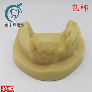 牙科材料下半f口种植练习模型发泡缺失种植练习教学模型M2028