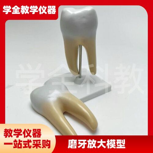 磨牙放大模型 蛀牙 牙齿r结构 口腔牙医学 牙科医患沟通 尖牙切牙