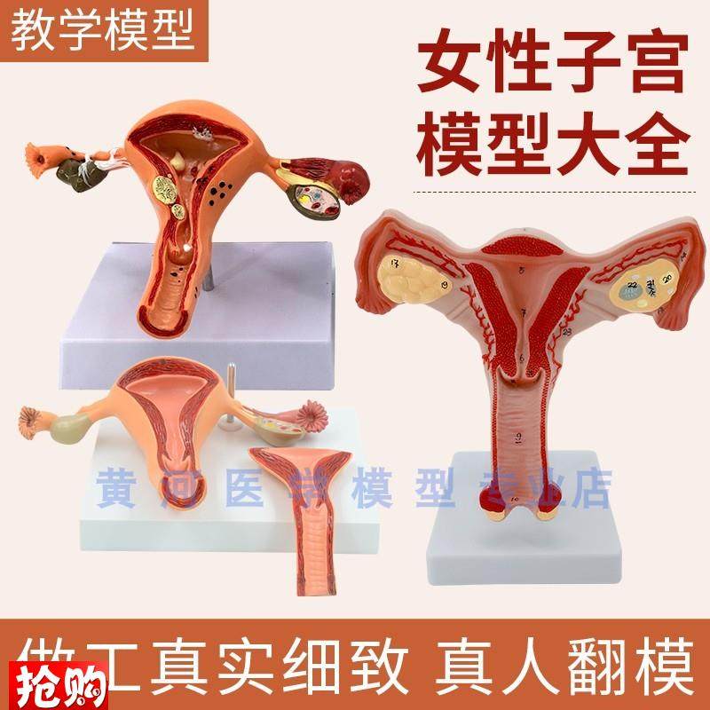 人体子宫病理卵巢阴道女性内外生殖器官模型生殖T科妇科医学演示