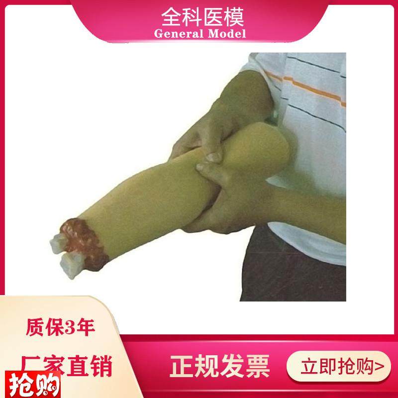 上肢外伤断肢n止血模型上肢止血模型