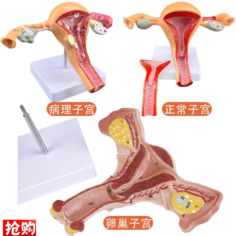 人体模型女性生殖子宫模型阴道卵巢模型教K学模具子宫病理演示模