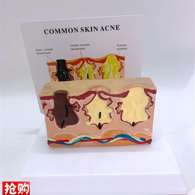 人体皮肤解剖模型病变皮囊病理演示毛H发油脂生长过程酒糟皮肤放