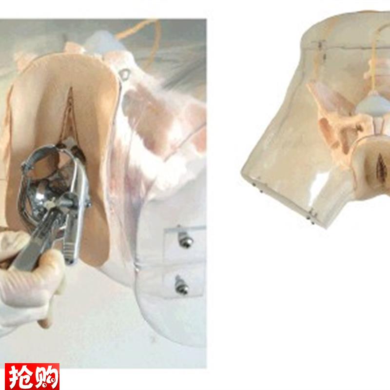 高级透明刮宫模型