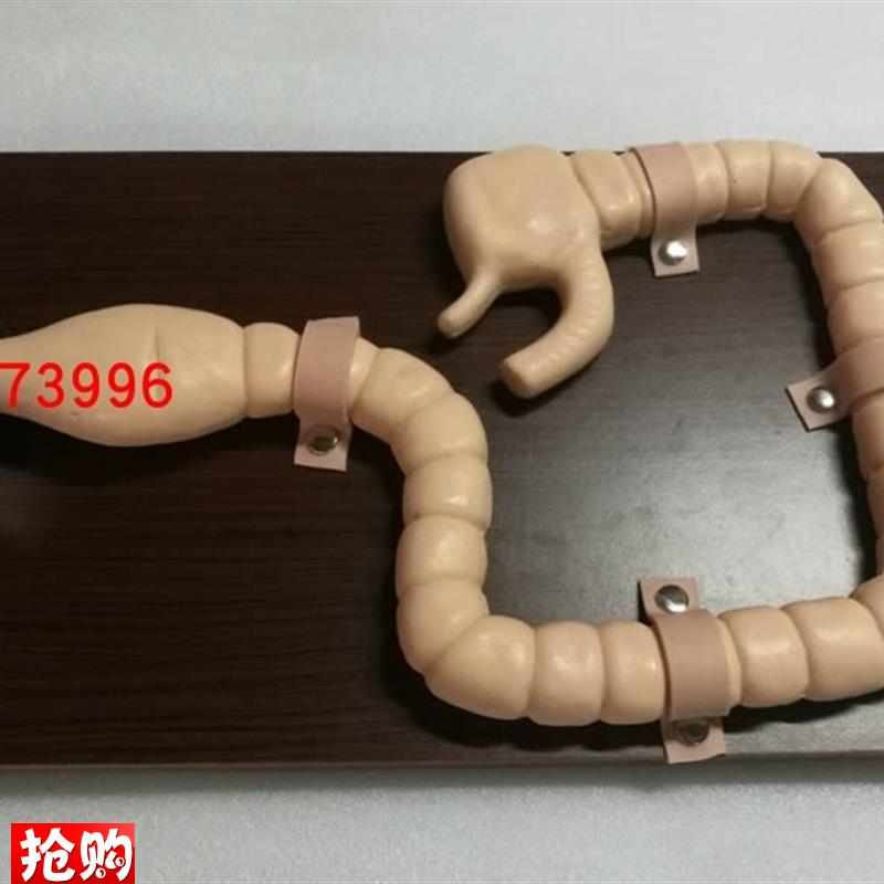 乙状结肠镜i检查模型大肠肠道病变检查模型