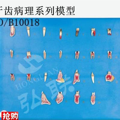 全科医生aGD/B10018牙齿病理系列模型
