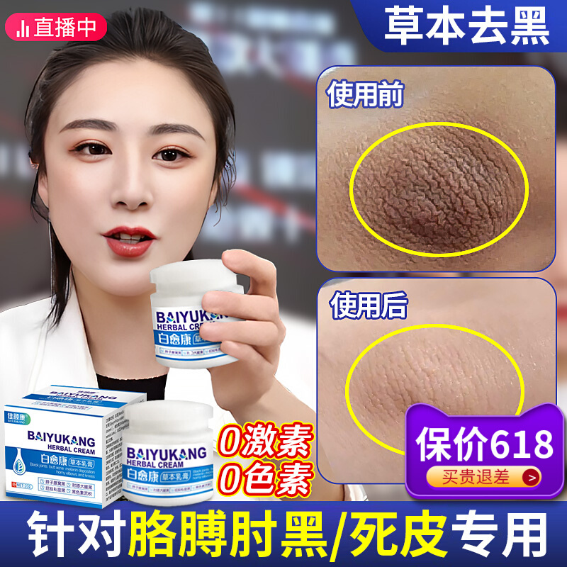 胳膊肘去黑去死皮手关节手指膝盖手肘脖子腋下屁股坐印发黑神器