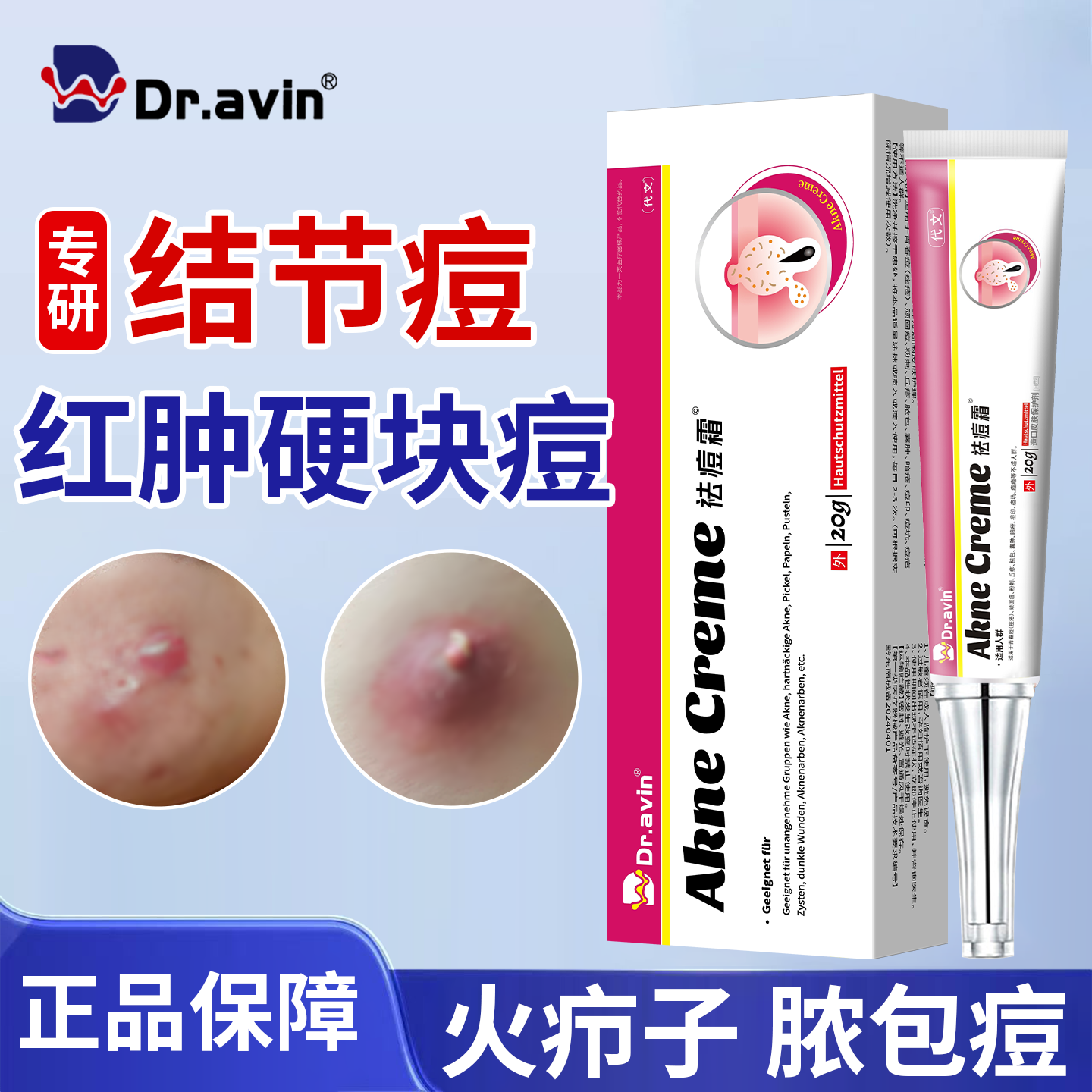 火疖子拔毒拔脓膏脓包结节硬块痘疙瘩痤疮祛重度痘暗疮特膏效药KT