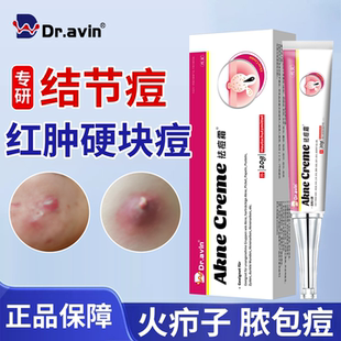 火疖子拔毒拔脓膏脓包结节硬块痘疙瘩痤疮祛重度痘暗疮特膏效药KT