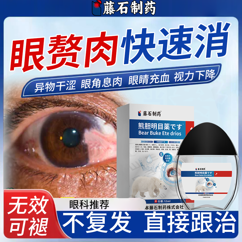 去除眼睛胬肉滴眼液眼角长翼状胬肉息肉眼模糊异物感疙瘩眼药水KT
