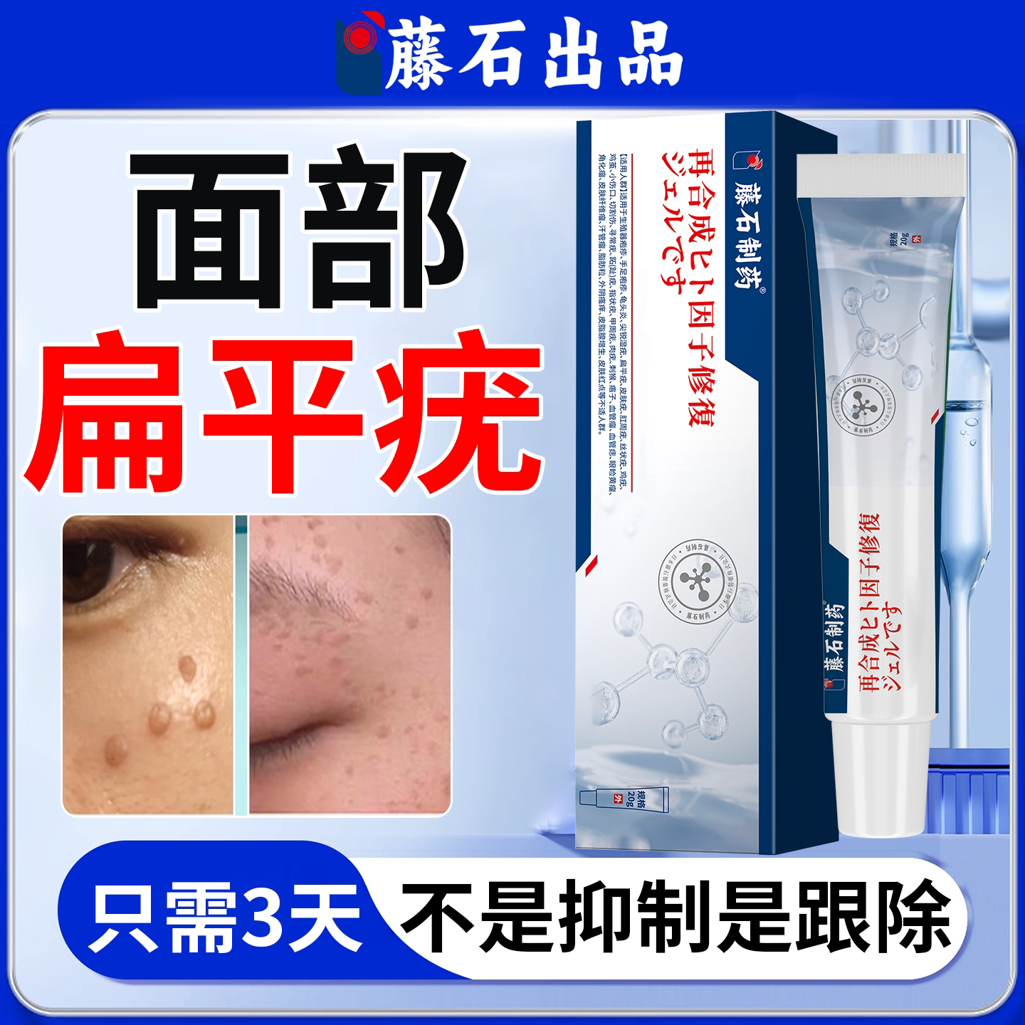 脸上扁平疣去除膏一抹灵丝状神器皮肤消毒护理（消）
