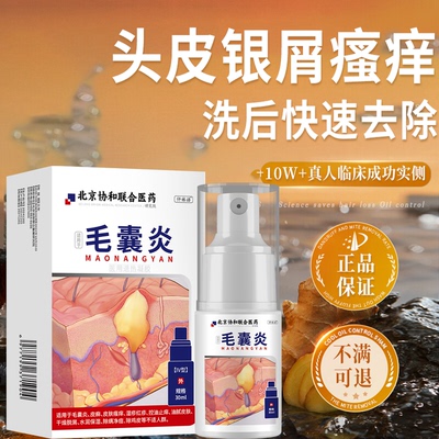头皮银屑病牛皮专用洗发水药膏瘙痒去屑控油煤焦油洗剂KT