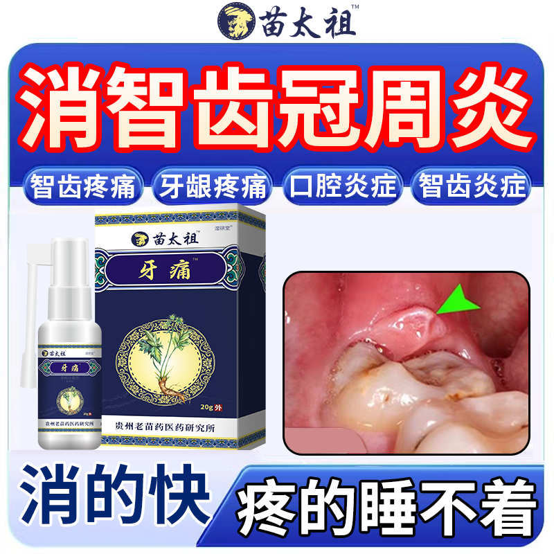 智齿冠周炎牙龈牙齿脓包肿痛疼消炎专用漱口水药喷雾喷剂KT,洗护清洁剂/卫生巾/纸/香薰,口鼻清洁杀菌消炎剂,淘宝优惠券,粉丝福利购,淘宝优惠卷