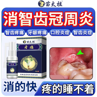 智齿冠周炎牙龈牙齿脓包肿痛疼消炎专用漱口水药喷雾喷剂KT