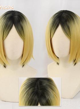 高档SUCOS 球少年 日向翔阳漫 动c排osN假发 打毛加厚造型款反翘