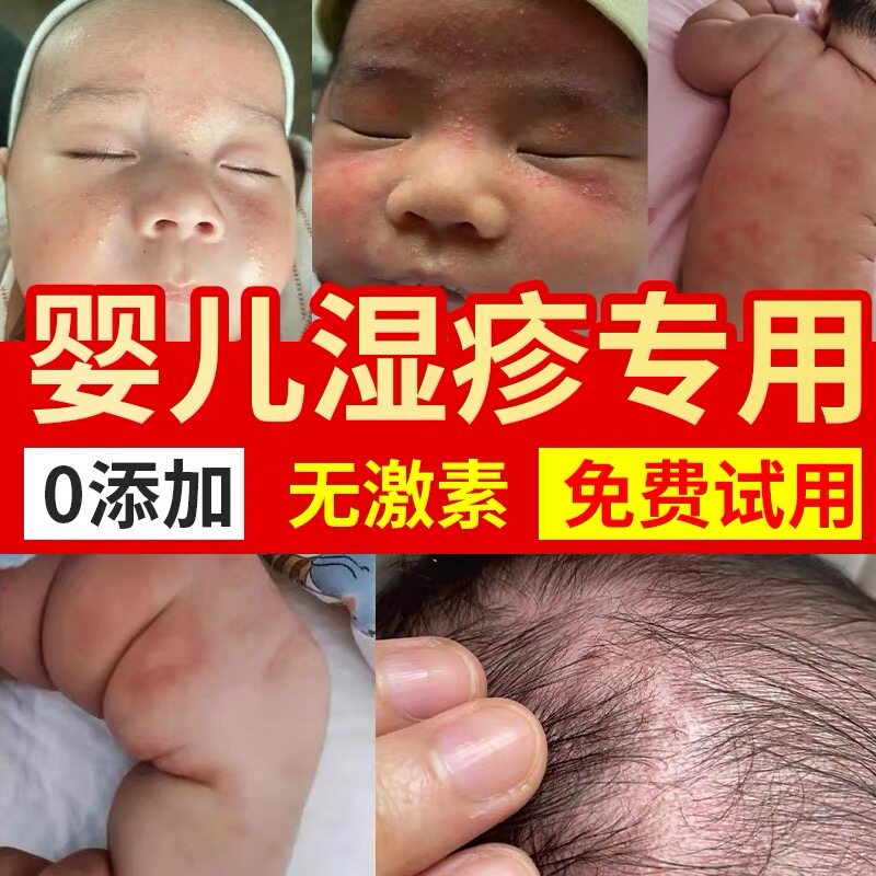 宝宝湿疹膏婴儿专用无激素奶藓去口水疹热疹痤疮干性红屁股止痒根