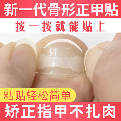 梵庄公第四代嵌甲贴片专业纠正