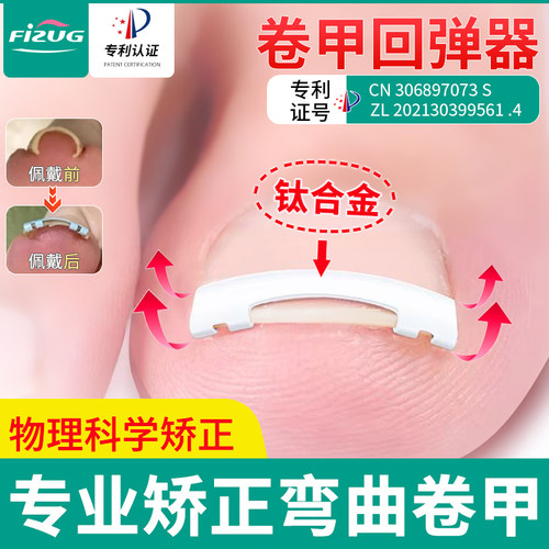 镍钛合金卷甲回弹矫正器国家专利