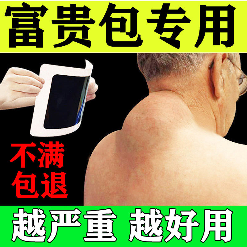 颈椎贴富贵包正品肩颈痛专用贴膏鼓包疏通颈部贴修复消除贴