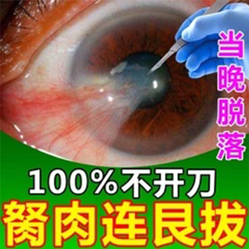 钹云锭仁目滴眼液飞蚊症缓解眼睛疲劳干眼症视物模糊医用官方