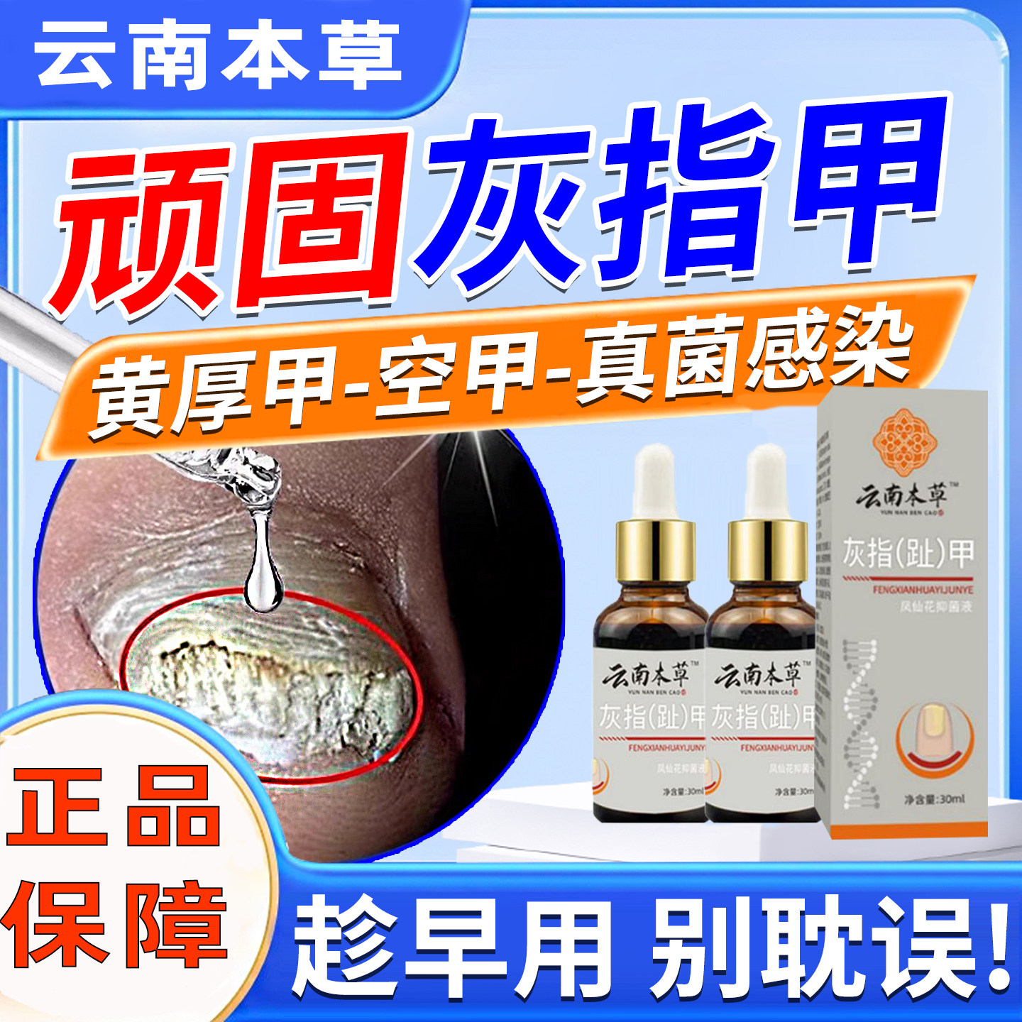 云南本草灰指甲抑菌液脱甲油甲沟甲板脱落脚趾发黄专用官方正品my