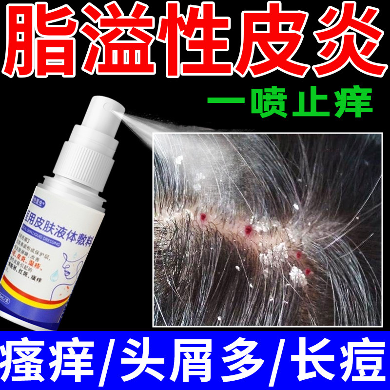 哲也医生医用脂溢性皮炎头皮真菌感染头廯红肿去屑止痒专用喷雾my