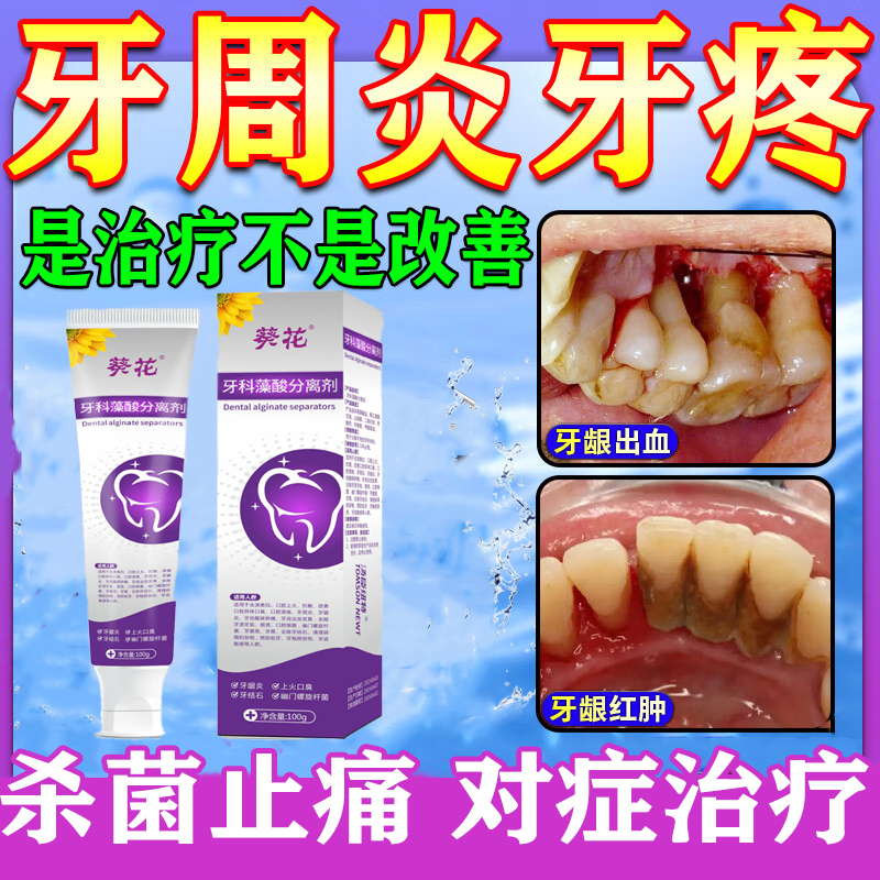 牙齿敏感酸痛药房同售医用型非牙膏口腔护理脱敏膏治疗过敏酸软an