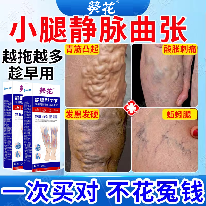 脉管炎老烂腿治疗蚯蚓腿血凝胶红血丝管静脉曲张青筋凸起药贴膏aw