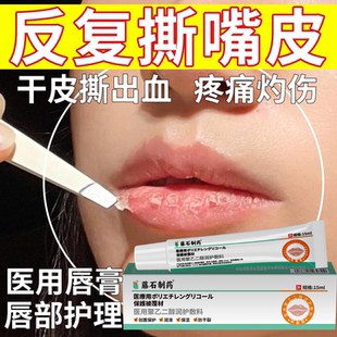 反复撕嘴皮唇炎唇膏医用嘴唇干裂脱皮流血儿童成人润唇保湿滋润PG