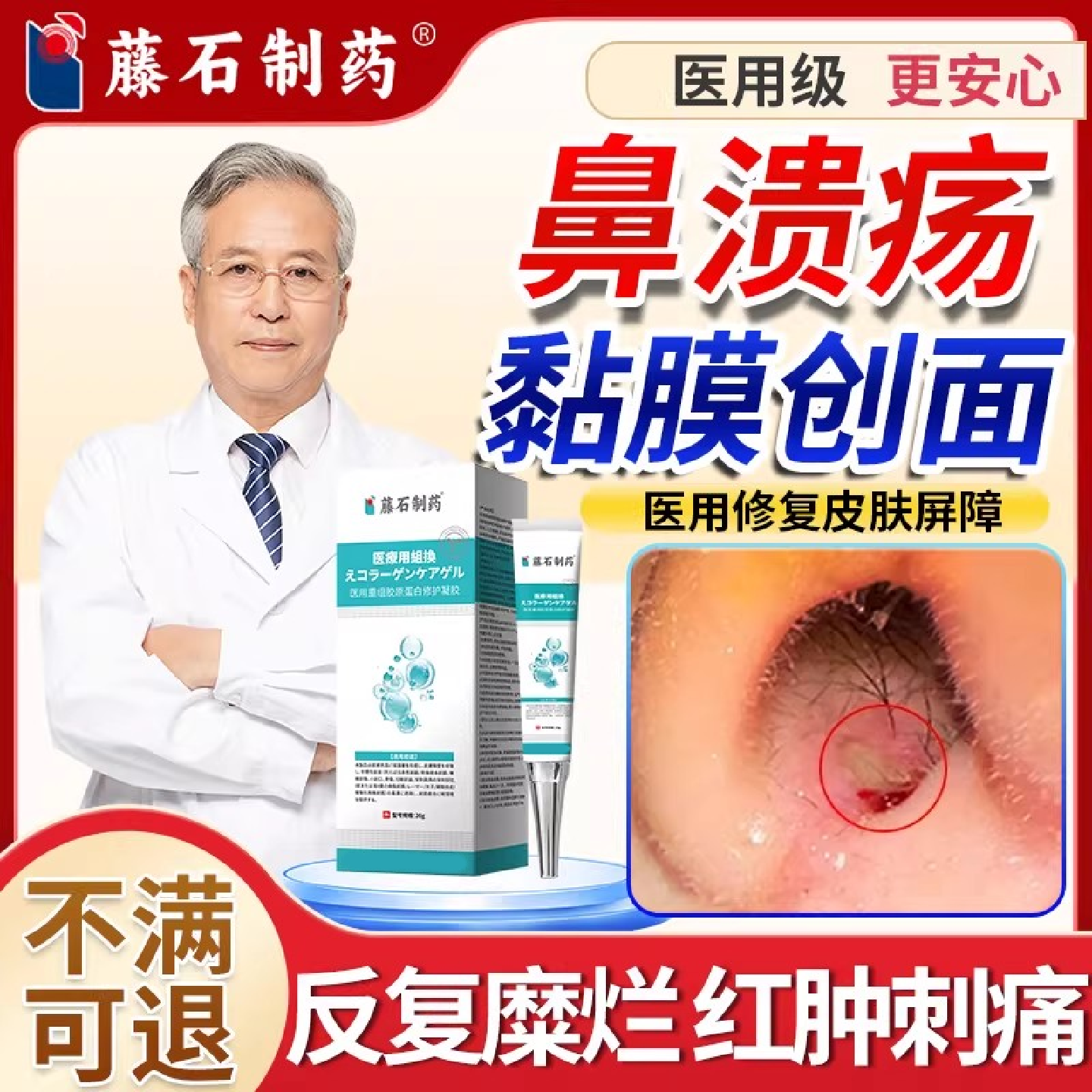 鼻中隔鼻腔溃疡鼻粘膜糜烂干燥性修复凝胶上火鼻子生疮肿痛结痂SK