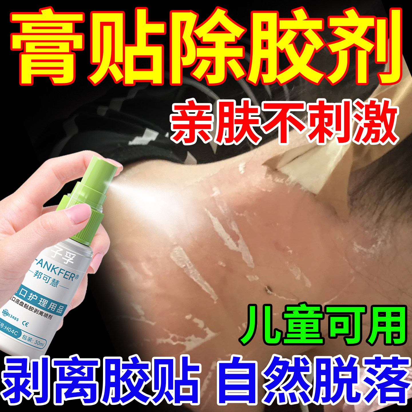膏药贴医用皮肤除胶剂婴儿童减张器贴医用解胶去胶带粘痕除胶剂RW图片