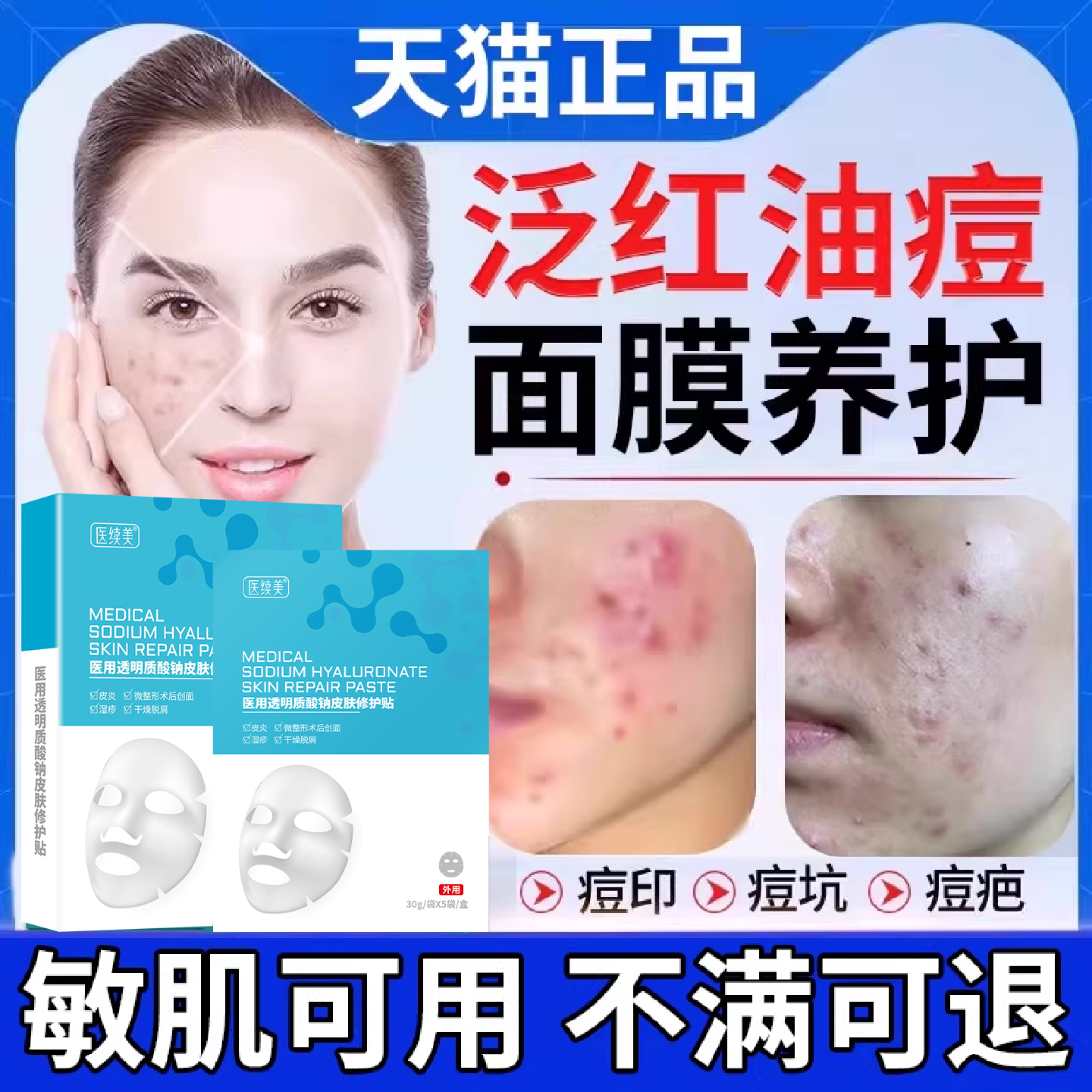 面部泛红去痘印小疙瘩面膜补水修复屏障去痘坑脓包除清洁膏SK