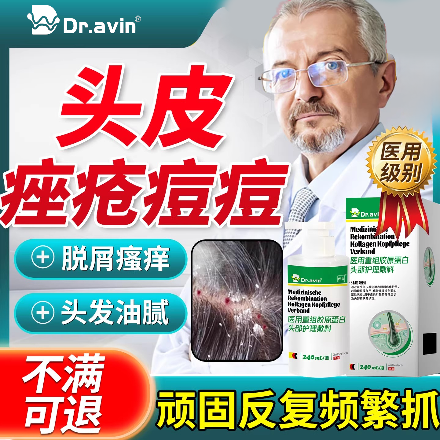 头皮痤疮痘痘硬疙瘩真菌感染洗发水马拉色菌头癣干燥脱屑止痒SK