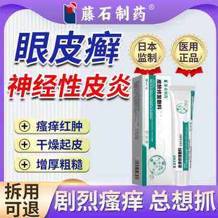 眼皮癣神经性皮炎眼睛周围眼角痒干燥起皮掉屑红肿痒过敏药膏VX