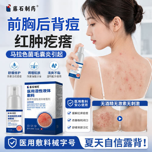 前胸后背长痘痘毛囊炎马拉色菌粉刺特祛红疙瘩效喷雾药房同售膏SK