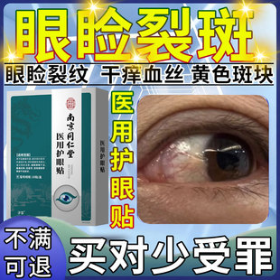 眼睑裂斑搭叶黄素眼药水眼白发黄眼睛清澈去黄浑浊黄斑病变眼贴CA