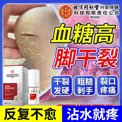 血糖高脚干裂喷雾剂脚后跟干裂起硬皮修复膏角化型脚气真菌感染PG
