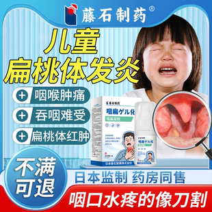 儿童扁桃体炎肥大肿大喷雾喷剂药房同售发炎喉咙肿痛溃疡咽喉贴RW