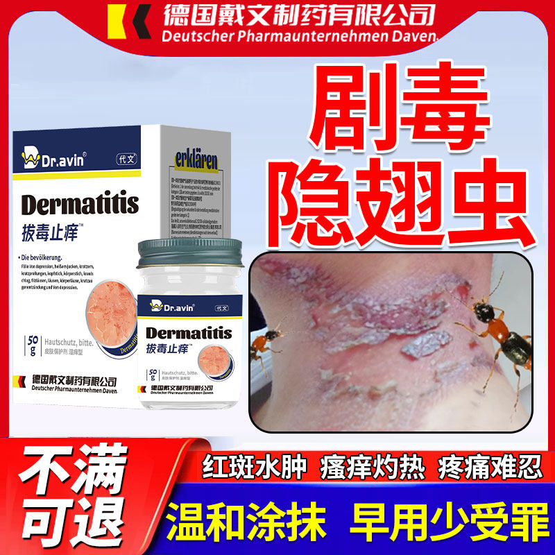 隐翅虫叮咬皮炎皮肤红斑水肿水泡糜烂止痒可搭膏药贴火红蚁臭虫qk