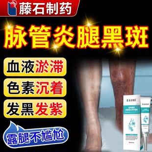 脉管炎老烂腿静脉曲张色素沉着小腿黑斑皮肤发黑斑点药房同款CA