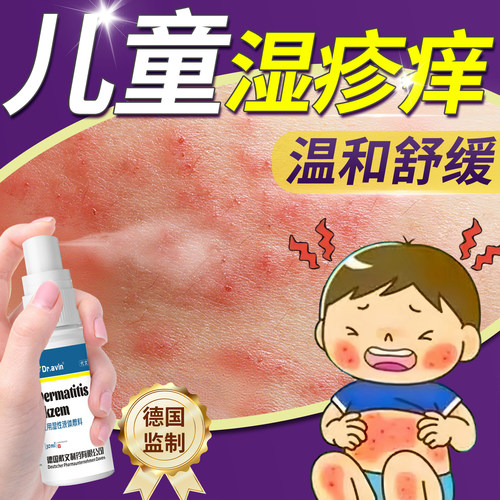 儿童湿疹软膏药房同售止痒霜去非无激素根过敏特应性皮炎瘙痒JA