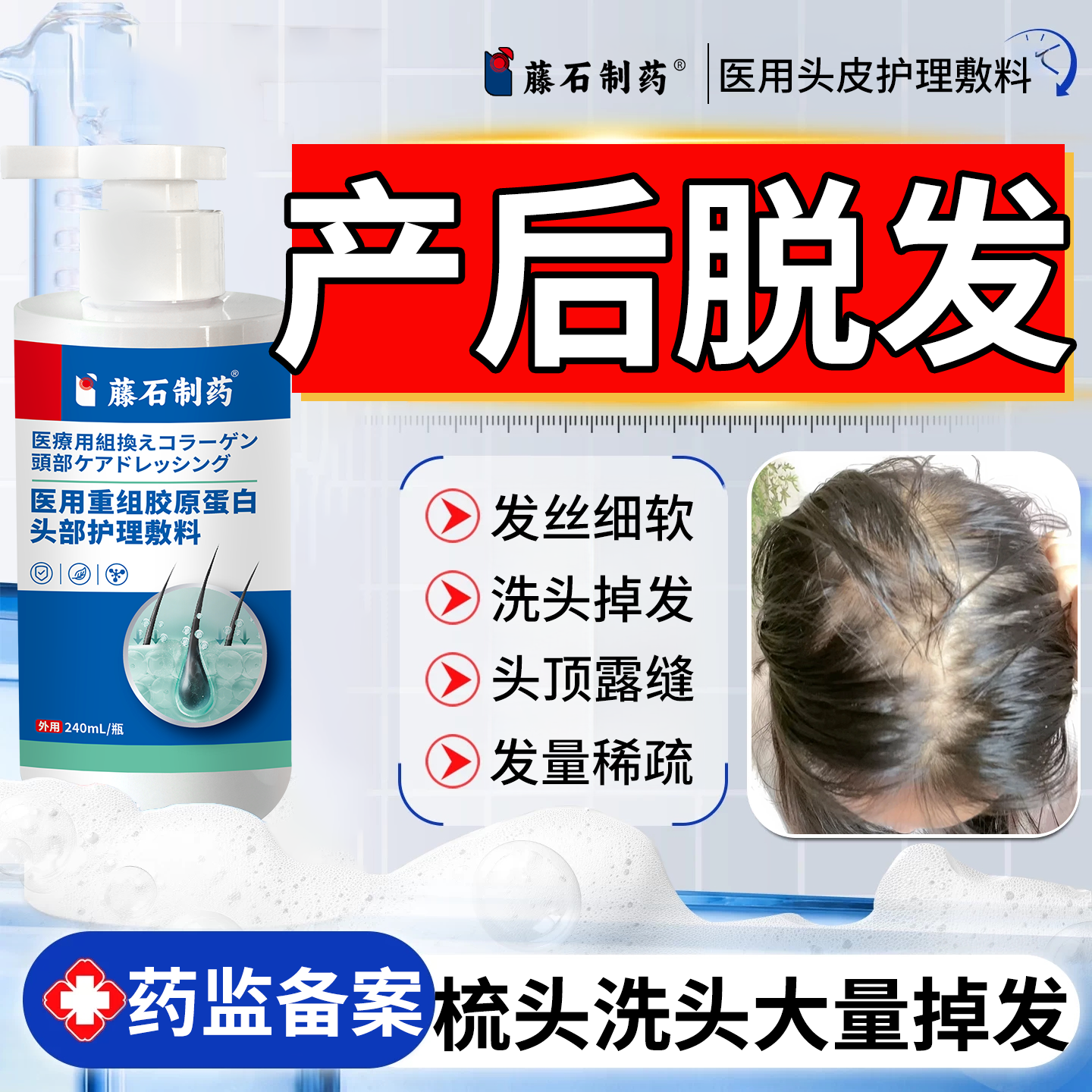 产后脱发脂溢性斑秃调理专用生发增发可搭食补生发液洗发护理YI