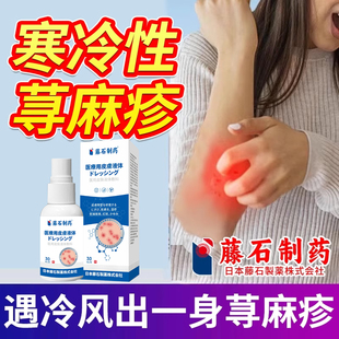 寒冷性寻荨麻疹慢性过敏专用止痒皮肤提高免疫力药房同售SK
