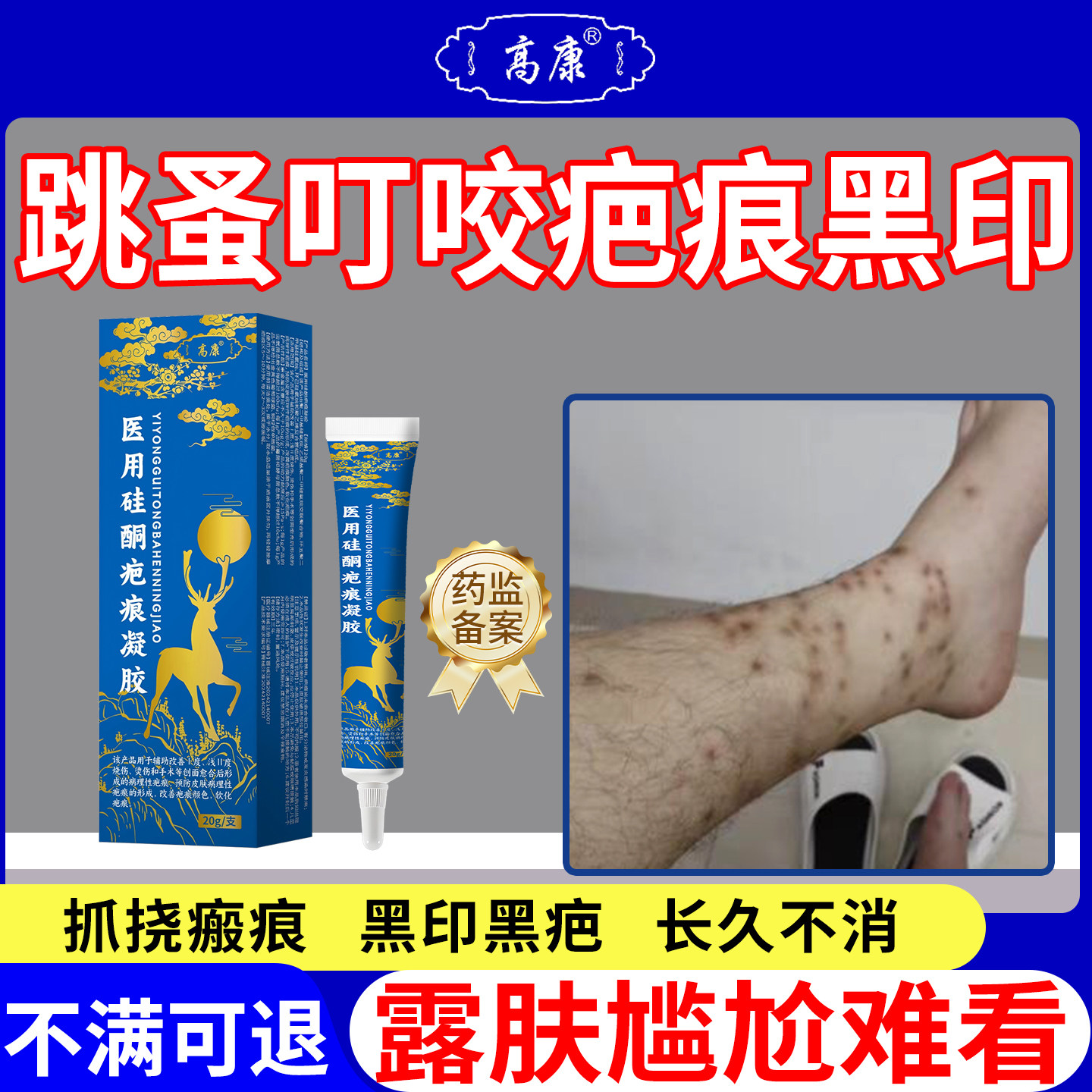 跳蚤蚊虫叮咬去黑印黑色素沉淀图片